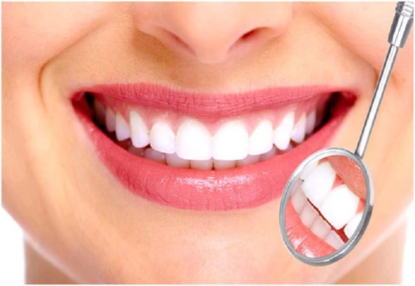 Bọc răng thưa liệu có tốt hơn hàn trám răng thẩm mỹ hay không? - Nha Khoa Home