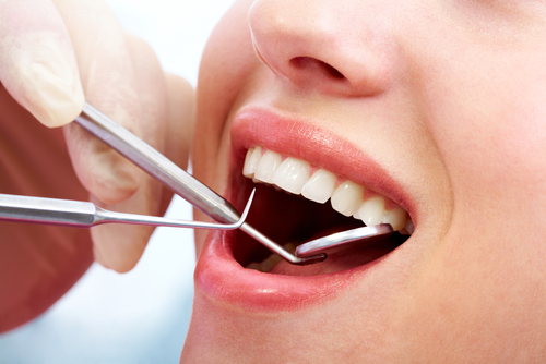 Bọc răng sứ được bao lâu? Làm thế nào để giữ răng sứ luôn bền đẹp - Nha Khoa Home