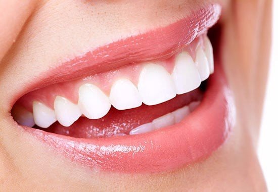 Thắc mắc tẩy trắng răng có hại không? - Nha Khoa Home