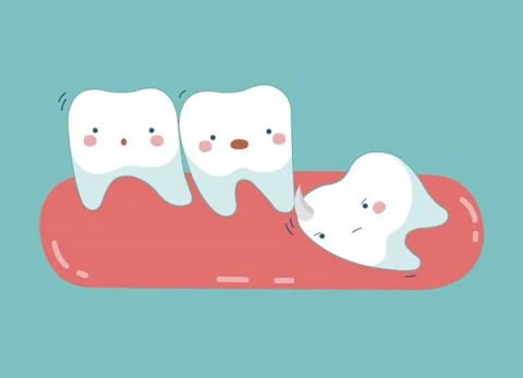 dentist in armadale wisdom teeth removal 800x579 18eda326c80b4c4c9eace0b8ff77059c large