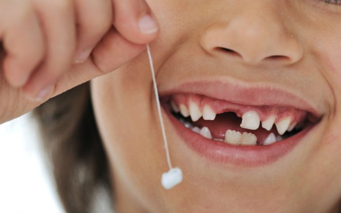Những thông tin cơ bản mà cha mẹ nên biết khi nhổ răng sâu cho trẻ – Nha  Khoa Home