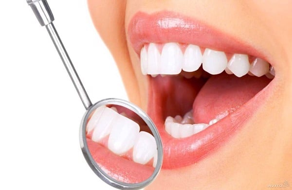 Thắc mắc tẩy trắng răng có hại không? - Nha Khoa Home