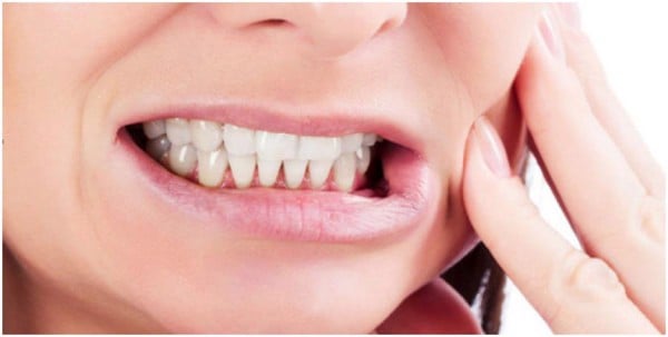 Nghiến răng là một vấn đề gây ảnh hưởng rất xấu tới sức khỏe răng miệng.