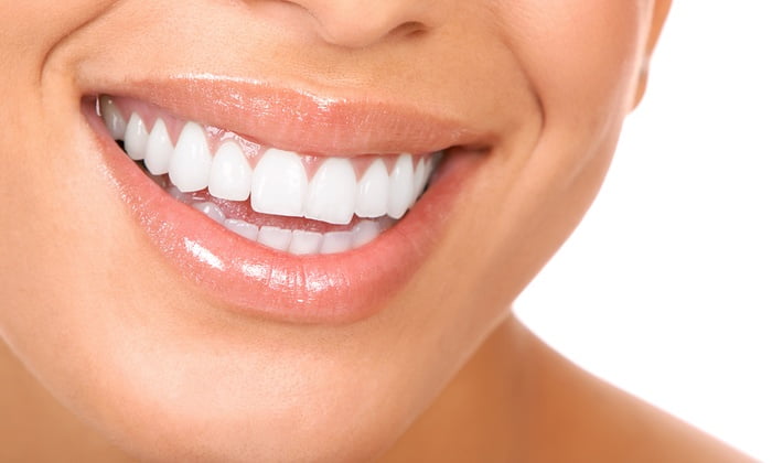5 nhân tố ảnh hưởng đến màu sắc răng miệng của bạn trong quá trình tẩy trắng - Nha Khoa Home