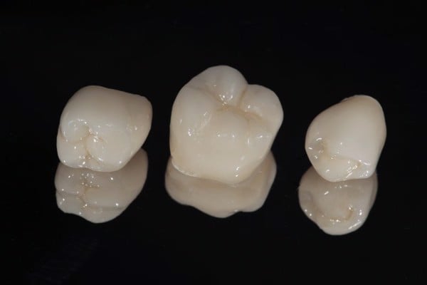 Cầu răng là một giải pháp khôi phục hình răng hiện đại, sử dụng một thiết bị chụp lên hoàn toàn chiếc răng