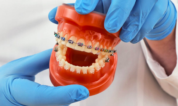 Bác sĩ chỉnh nha biết cách cân bằng thẩm mỹ với chức năng để mang lại cho bạn kết quả hoàn hảo và cải thiện sức khỏe răng miệng của bạn.