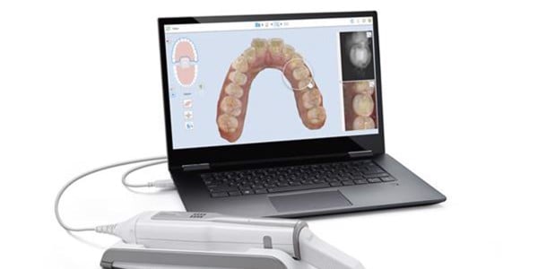 Công nghệ Itero Element 5D - Công nghệ lấy dấu răng hiện đại nhất thế giới - Nha Khoa Home
