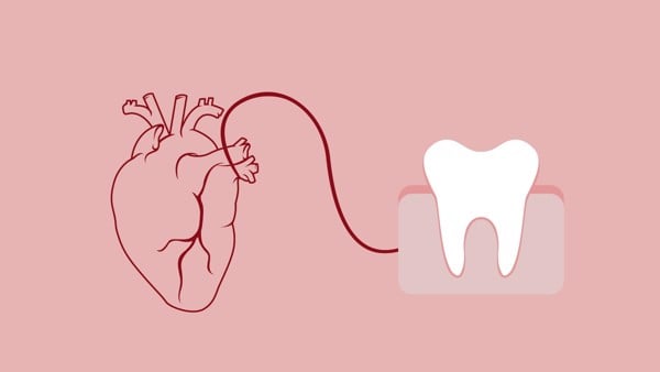Sức khỏe răng miệng có nhiều tác động tới vấn đề tim mạch của bạn.