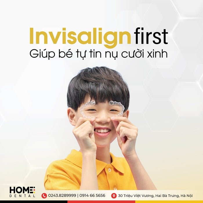 Invisalign First - (Chỉnh nha sớm) phương pháp niềng răng mới cho trẻ