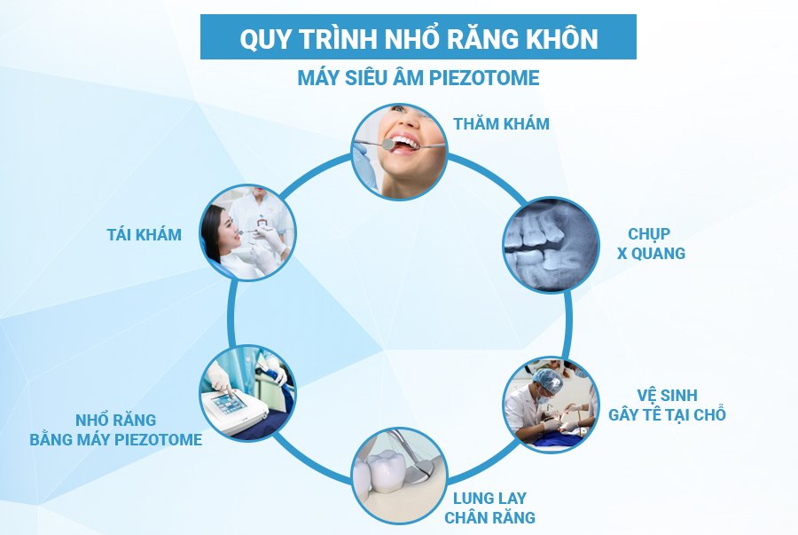 Quy trình nhổ răng khôn bằng máy siêu âm Piezotome - Nha khoa Lạc Việt  Intech