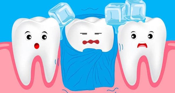 Răng nhạy cảm là gì?