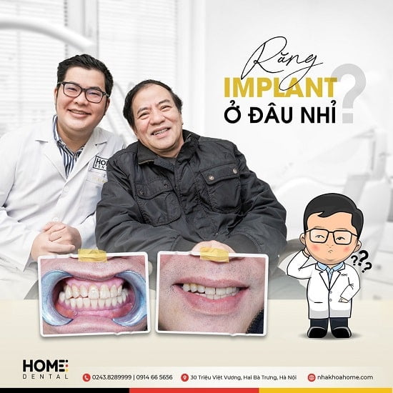Trồng răng Implant an toàn, nhanh hồi phục tại Nha Khoa Home Dental