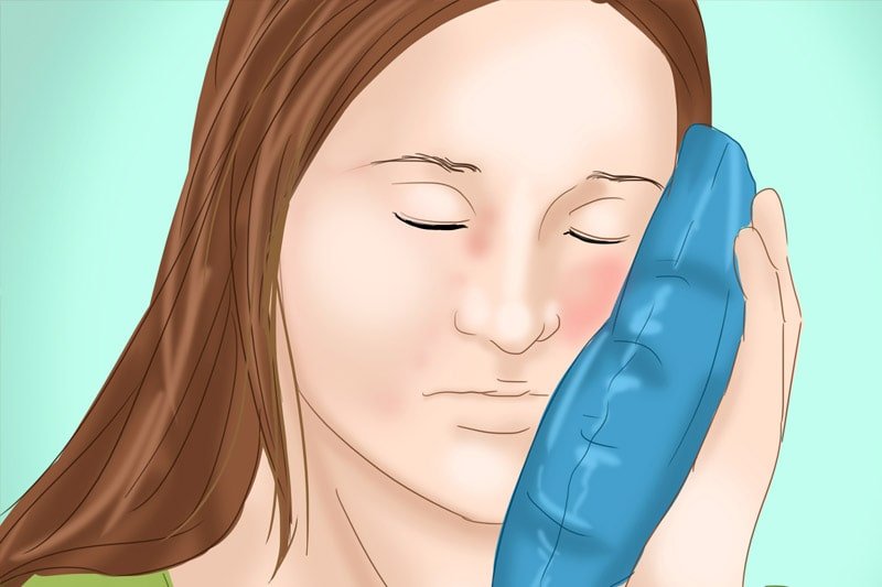 Chườm nóng làm giảm sưng má sau khi nhổ răng