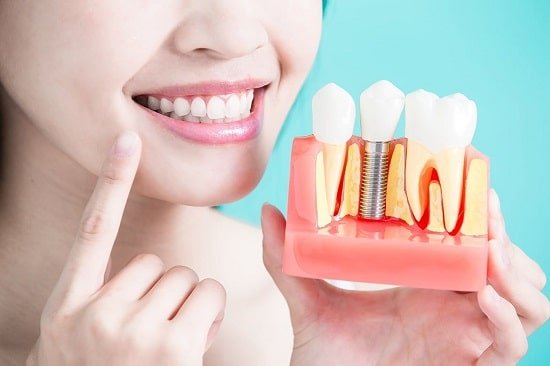 Nguyên nhân giúp quá trình trồng răng implant không đau là gì?