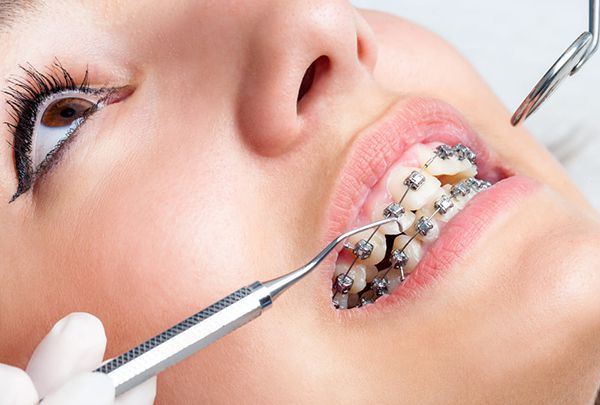 Đánh lún răng có đau không?