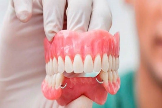 Nguyên nhân hàm răng giả bị lỏng và cách xử lý tức thì