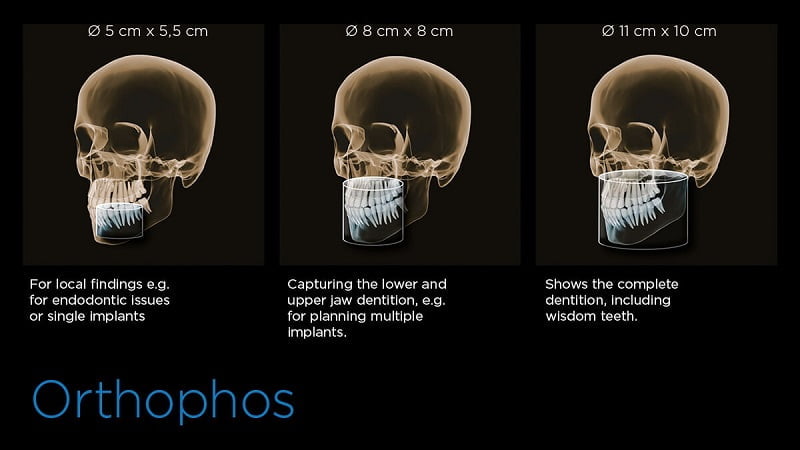 Giới thiệu máy chụp phim CT Cone Beam 3D - Nha Khoa Home