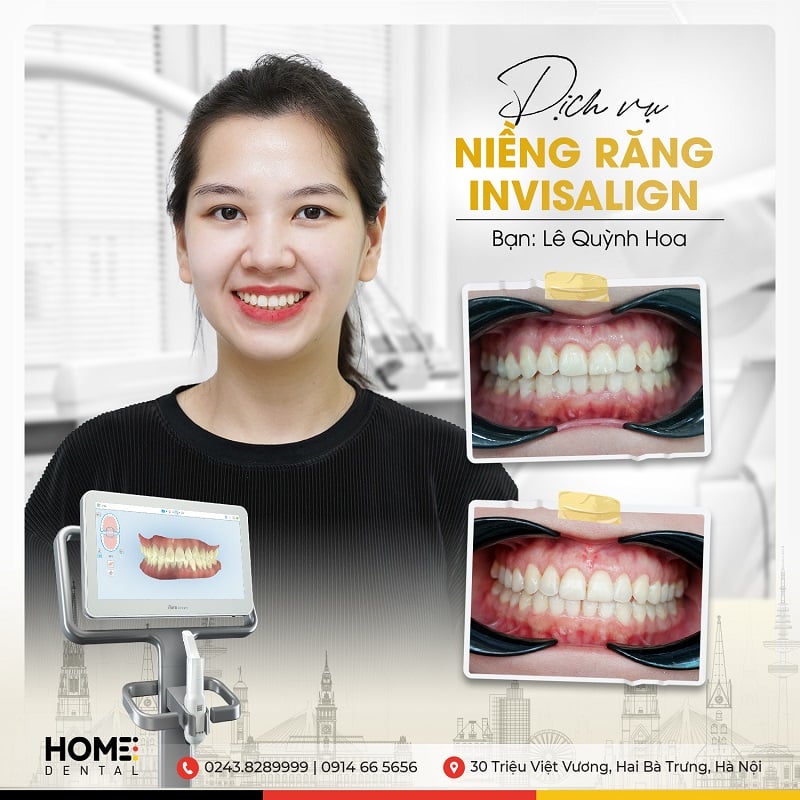 Trang chủ - Nha Khoa Home Trang chủ - Nha Khoa Home