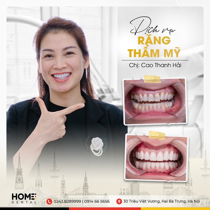 Trang chủ - Nha Khoa Home Trang chủ - Nha Khoa Home