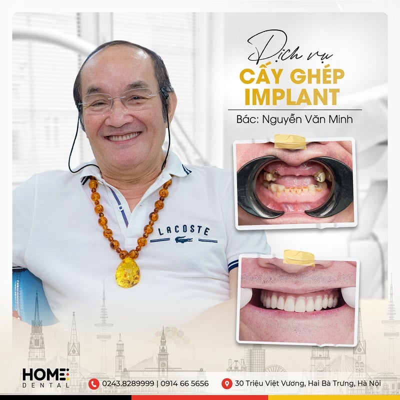 Trang chủ - Nha Khoa Home Trang chủ - Nha Khoa Home