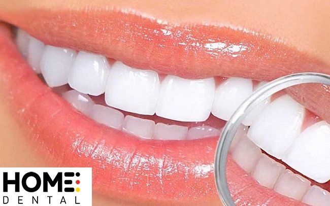 Răng Sứ Diamond Là Gì? Có tốt không? Giá bao nhiêu?