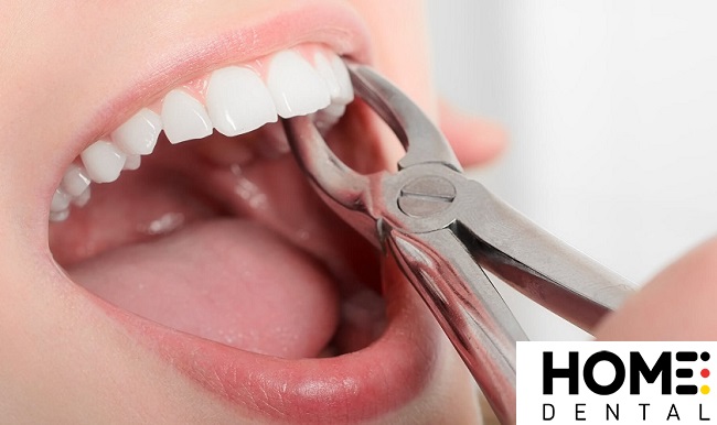 Tác hại của việc nhổ răng số 4 là gì?