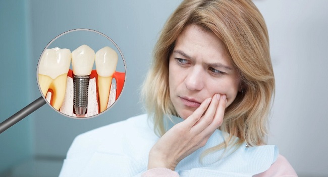 Cách tránh biến chứng khi trồng răng implant